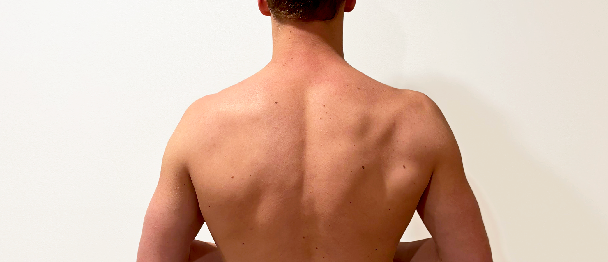 Young Man's Back After 28 Hours