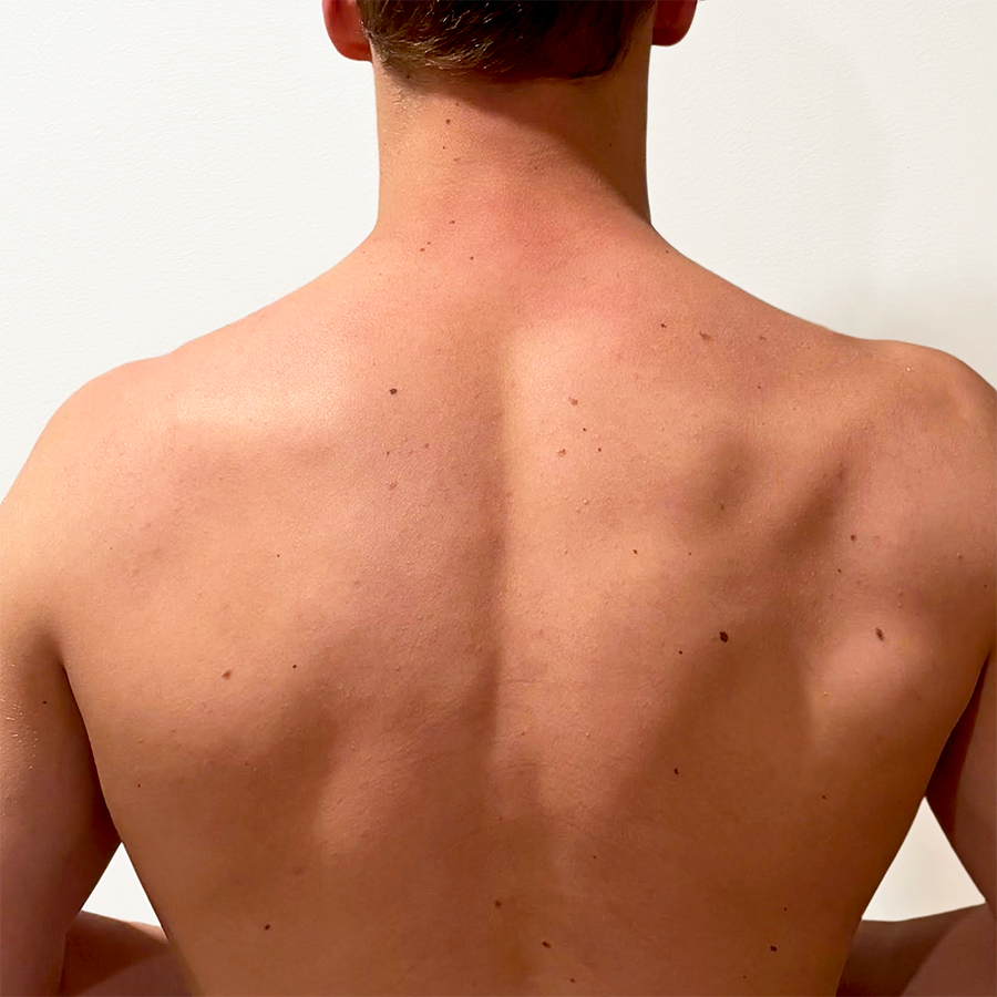 Young Man's Back After 28 Hours