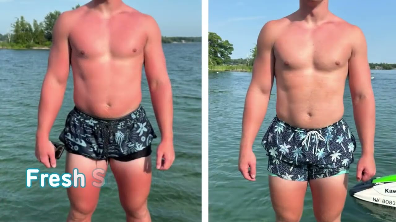 Load video: The 100% Natural Way to Recover from Sunburn